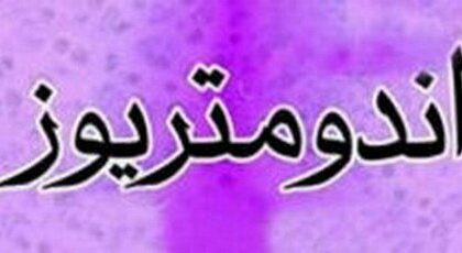 مکمل آنتی‌اکسیدانی «ان استیل‌سیستئین»؛ امید تازه برای کاهش درد آندومتریوز