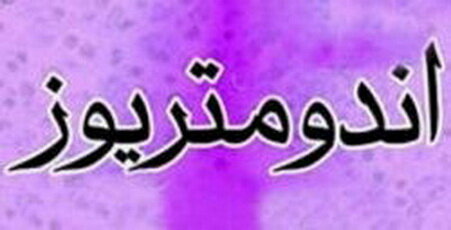 مکمل آنتی‌اکسیدانی «ان استیل‌سیستئین»؛ امید تازه برای کاهش درد آندومتریوز